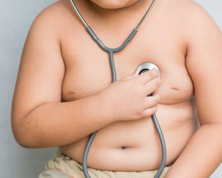 Nadváha a obezita u dětí